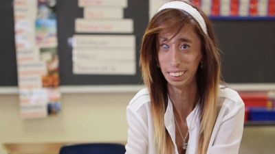 Lizzie Velasquez